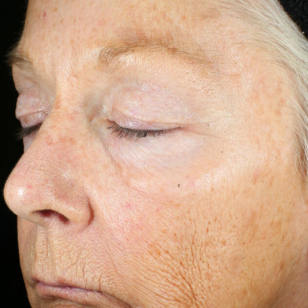 Zoskin - Before
